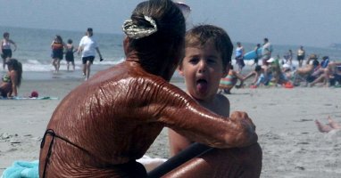 10 Incredibly Terrible Sunburns And Tips On How To Avoid A Similar Fate