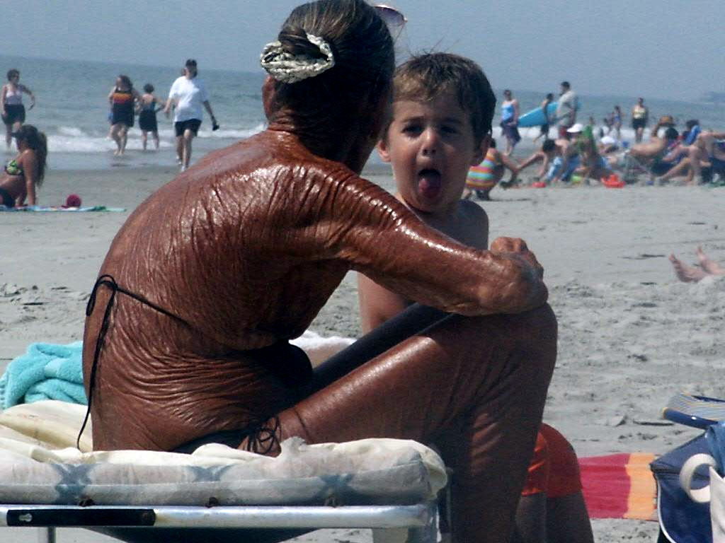 10 Incredibly Terrible Sunburns And Tips On How To Avoid A Similar Fate